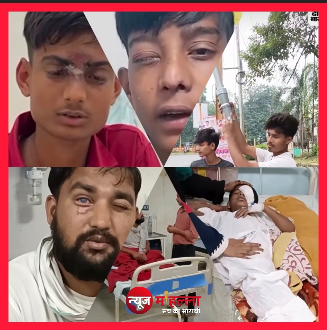 भोपाल में ‘देसी पटाखा गन’ से आंख-कान की गंभीर चोटें , डॉक्टरों ने दी चेतावनी, अगली दिवाली तक सतर्क रहें